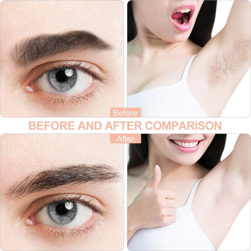 Hair Remover Flawless - Facial Hair Remover For Women Skincare Lipstick Shape Mini Epilator Trimmer Machine For Face Flawless, Upper Lip Chin Eyebrow Hair Remover Etc With Battery
